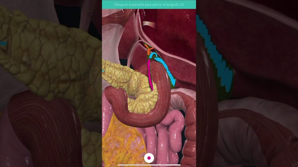 Detección de deformaciones en tuberías interiores