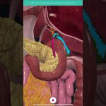 Detección de deformaciones en tuberías interiores